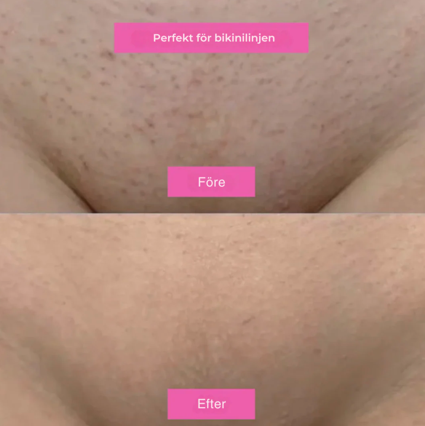 Hårborttagningsolja 60ml- Naturligt len hud utan Rakhyvel
